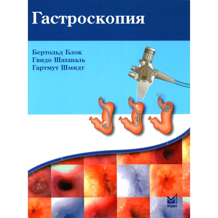 Гастроскопия. 5-е издание. Блок Б., Шахшаль Г., Шмидт Г.