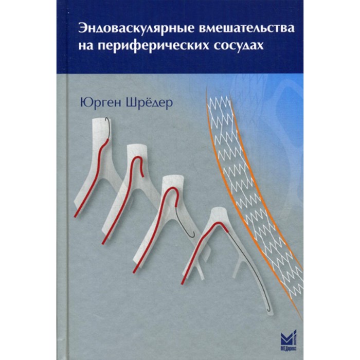 

Эндоваскулярные вмешательства на периферических сосудах. Шредер Ю.