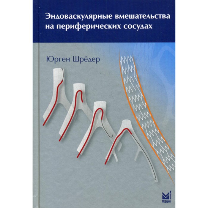 Эндоваскулярные вмешательства на периферических сосудах. Шредер Ю. шредер юрген эндоваскулярные вмешательства на периферических сосудах