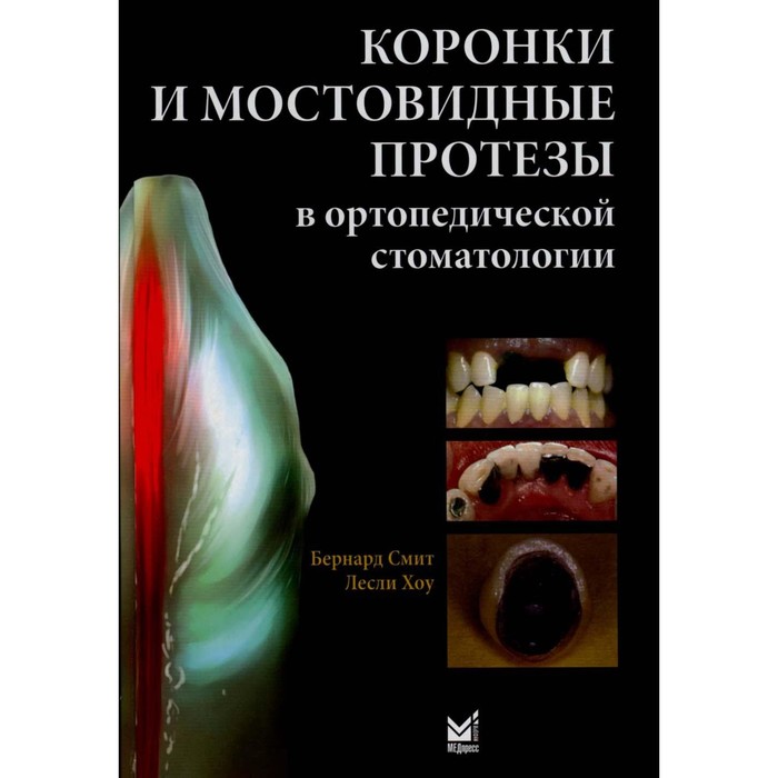 

Коронки и мостовидные протезы в ортопедической стоматологии. Смит Б.