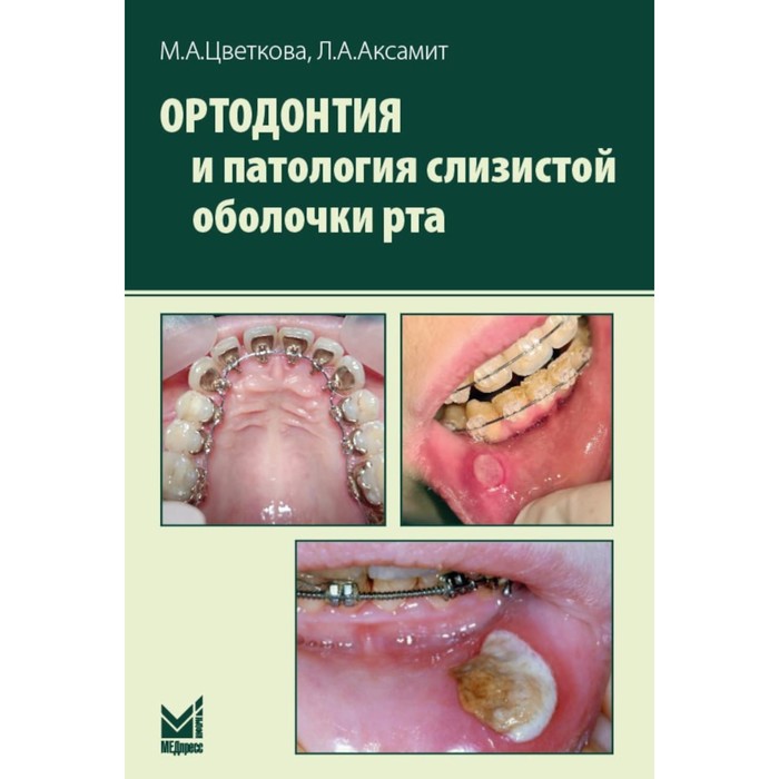 Ортодонтия и патология слизистой оболочки рта. Аксамит Л.А., Цветкова М.А.
