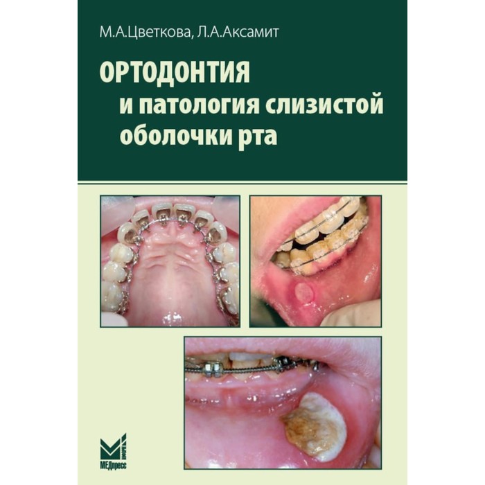 

Ортодонтия и патология слизистой оболочки рта. Аксамит Л.А., Цветкова М.А.