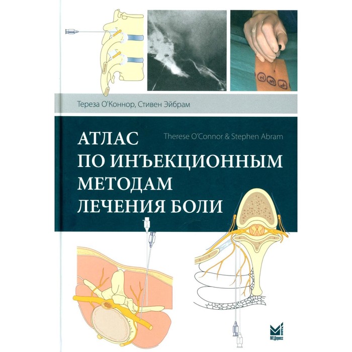 

Атлас по инъекционным методам лечения боли. 2-е издание. О'Коннор Т., Эйбрам С.