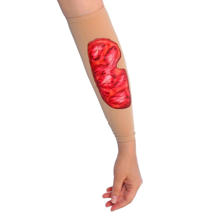 Рана на руку "Ожёг"